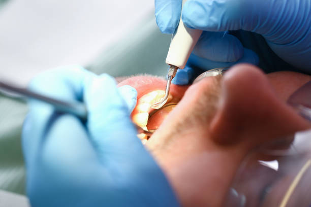 Best Emergency Wisdom Teeth Removal in Mustang Ridge, TX